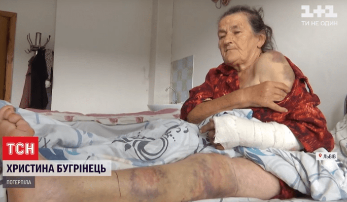 Постраждала жінка.