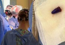 Дитина проковтнула ковпачок від ручки: лікарі провели складну операцію у Львові